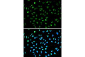 Immunofluorescence analysis of A549 cell using ATF6 antibody. (ATF6 Antikörper  (AA 1-190))