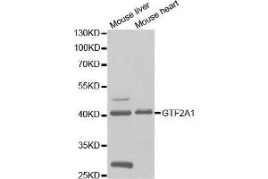 Western Blotting (WB) image for anti-General Transcription Factor IIA, 1, 19/37kDa (GTF2A1) antibody (ABIN1876533)