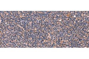 Immunohistochemistry of paraffin-embedded Human tonsil tissue using JAM3 Polyclonal Antibody at dilution of 1:45(x200) (JAM3 Antikörper)
