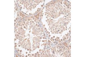 Immunohistochemistry of paraffin-embedded mouse testis using VEGF Receptor 2 antibody (ABIN6132247, ABIN6142816, ABIN6142819 and ABIN6215074) at dilution of 1:100 (40x lens). (VEGFR2/CD309 Antikörper  (AA 20-200))