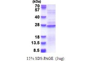 SDS-PAGE (SDS) image for Ribosomal Protein L18a (RPL18A) (AA 1-176) protein (His tag) (ABIN5853691)