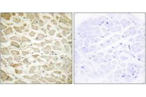 Immunohistochemistry analysis of paraffin-embedded human heart tissue, using Collagen XIV alpha1 Antibody. (COL14A1 Antikörper  (AA 71-120))