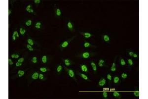 Image no. 4 for anti-A Kinase (PRKA) Anchor Protein 8 (AKAP8) (AA 551-663) antibody (ABIN599126) (AKAP8 Antikörper  (AA 551-663))