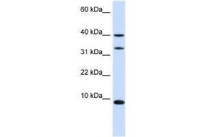 DBI antibody used at 1 ug/ml to detect target protein. (Diazepam Binding Inhibitor Antikörper)
