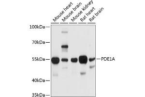 Western blot analysis of extracts of various cell lines, using PDE1A antibody (ABIN6131333, ABIN6145346, ABIN6145347 and ABIN6214718) at 1:1000 dilution. (PDE1A Antikörper  (AA 446-545))