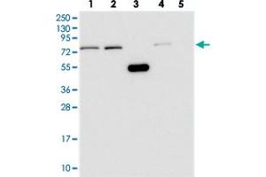 Western blot analysis of Lane 1: RT-4, Lane 2: U-251 MG, Lane 3: Human Plasma, Lane 4: Liver, Lane 5: Tonsil with WDR35 polyclonal antibody .