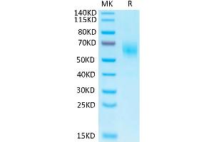 SDS-PAGE (SDS) image for Interleukin 1 Receptor-Like 2 (IL1RL2) (AA 20-335) protein (His-Avi Tag,Biotin) (ABIN7274903)