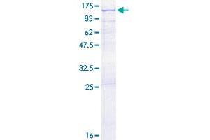 ACAP1 Protein (AA 1-740) (GST tag)