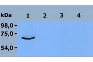 Western Blotting (WB) image for anti-zeta-Chain (TCR) Associated Protein Kinase 70kDa (ZAP70) (C-Term) antibody (ABIN238530) (ZAP70 Antikörper  (C-Term))