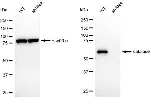 Western blotting analysis using catalase antibody (ABIN7797920).
