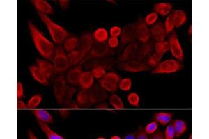 Immunofluorescence analysis of HeLa cells using VDAC3 Polyclonal Antibody at dilution of 1:100 (40x lens). (VDAC3 Antikörper)