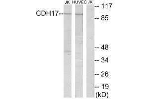 Western Blotting (WB) image for anti-LI Cadherin (Internal Region) antibody (ABIN1850218) (LI Cadherin Antikörper  (Internal Region))