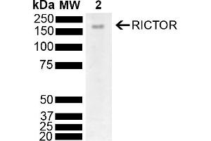 Western blot analysis of Mouse Brain showing detection of 192 kDa RICTOR protein using Rabbit Anti-RICTOR Polyclonal Antibody (ABIN5696206). (RICTOR Antikörper  (AA 1060-1160) (PerCP))