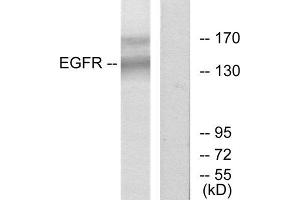 Western Blotting (WB) image for anti-Epidermal Growth Factor Receptor (EGFR) (Tyr1172) antibody (ABIN1848098) (EGFR Antikörper  (Tyr1172))