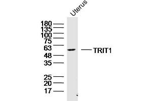 Mouse uterus lysates probed with TRIT1 Polyclonal Antibody, Unconjugated  at 1:300 dilution and 4˚C overnight incubation. (TRIT1 Antikörper  (AA 121-220))