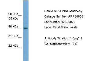 Western Blotting (WB) image for anti-Guanine Nucleotide Binding Protein (G Protein), alpha Inhibiting Activity Polypeptide 3 (GNAI3) (N-Term) antibody (ABIN2787873)