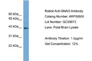 WB Suggested Anti-GNAI3  Antibody Titration: 0. (GNAI3 Antikörper  (N-Term))