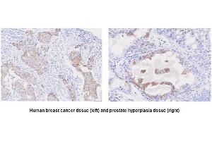 Immunohistochemistry (IHC) image for anti-Six Transmembrane Epithelial Antigen of The Prostate 1 (STEAP1) (AA 1-70), (N-Term) antibody (ABIN317568) (STEAP1 Antikörper  (N-Term))