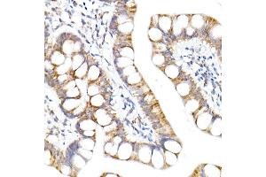 Immunohistochemistry of paraffin-embedded human small intestine using NDUF Rabbit mAb (ABIN7268797) at dilution of 1:50 (40x lens). (NDUFA1 Antikörper)