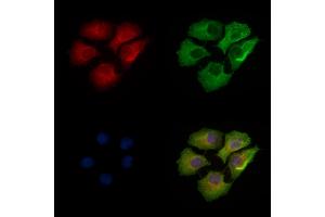 ABIN6256691 and ABIN6267080 staining Hela cells(heat shock treatment) by IF/ICC. (Connexin 43/GJA1 Antikörper  (pTyr265))