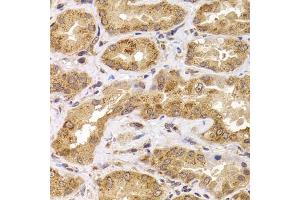 Immunohistochemistry of paraffin-embedded human kidney using  antibody (ABIN6127359, ABIN6136867, ABIN6136868 and ABIN6222919) at dilution of 1:100 (40x lens). (ANAPC5 Antikörper  (AA 1-250))