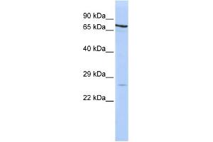 Western Blotting (WB) image for anti-Proteasome (Prosome, Macropain) Subunit, beta Type, 4 (PSMB4) (Middle Region) antibody (ABIN2786719)