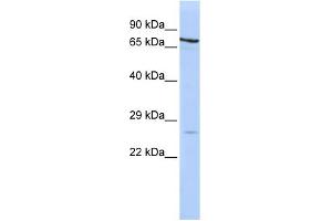WB Suggested Anti-PSMB4 Antibody Titration: 0. (PSMB4 Antikörper  (Middle Region))