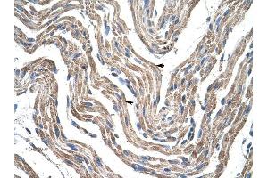 PDK4 antibody was used for immunohistochemistry at a concentration of 4-8 ug/ml to stain Skeletal muscle cells (arrows) in Human Muscle. (PDK4 Antikörper  (N-Term))