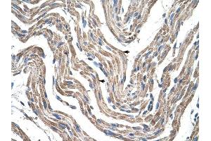 PDK4 antibody was used for immunohistochemistry at a concentration of 4-8 ug/ml to stain Skeletal muscle cells (arrows) in Human Muscle.