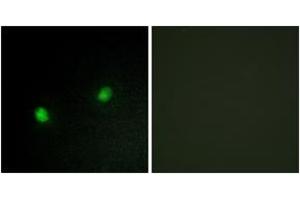Immunofluorescence analysis of HeLa cells, using ZNF7 Antibody. (ZNF7 Antikörper  (AA 41-90))