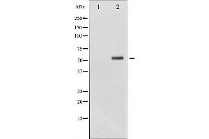 Western blot analysis of Chk2 phosphorylation expression in UV treated HeLa whole cell lysates,The lane on the left is treated with the antigen-specific peptide.