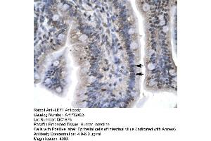 Immunohistochemistry (IHC) image for anti-Lymphoid Enhancer-Binding Factor 1 (LEF1) (C-Term) antibody (ABIN2779620)