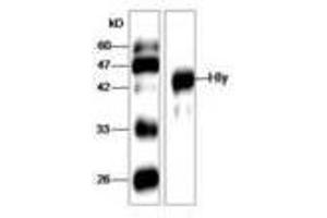 Image no. 1 for anti-Listeria Monocytogenes Hly (AA 20-119) antibody (ABIN791324) (Listeria Monocytogenes Hly (AA 20-119) Antikörper)