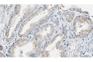 ABIN6276592 at 1/100 staining Human prostate tissue by IHC-P. (K-RAS Antikörper  (C-Term))
