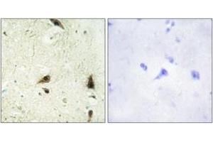 Immunohistochemistry analysis of paraffin-embedded human brain tissue, using CHRC1 Antibody.