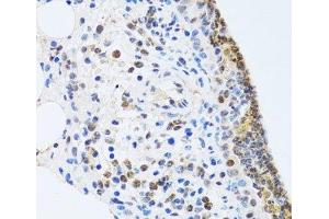 Immunohistochemistry of paraffin-embedded Rat lung using MTA3 Polyclonal Antibody at dilution of 1:100 (40x lens). (MTA3 Antikörper)