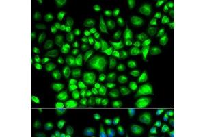 Immunofluorescence analysis of U2OS cells using BCAP31 Polyclonal Antibody (BCAP31 Antikörper)
