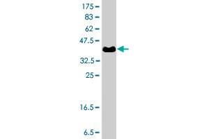 Western Blot detection against Immunogen (37. (CYP26B1 Antikörper  (AA 131-230))