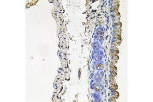 Immunohistochemistry of paraffin-embedded mouse lung using NDUFA6 antibody (ABIN6003563) at dilution of 1/100 (40x lens). (NDUFA6 Antikörper)