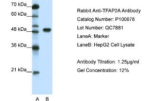 WB Suggested Anti-TFAP2A  Antibody Titration: 1. (TFAP2A Antikörper  (C-Term))