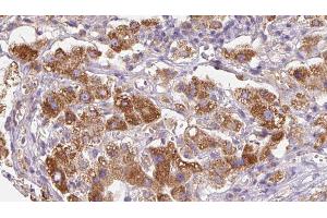 Immunohistochemistry (IHC) image for anti-Protein Tyrosine Phosphatase Receptor Type K (PTPRK) (Internal Region) antibody (ABIN6264523)