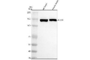 Western blot analysis of PLCB1 using anti-PLCB1 antibody (ABIN7605984).