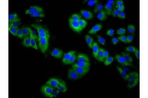 Immunofluorescence (IF) image for anti-Membrane Protein, Palmitoylated 3 (MAGUK P55 Subfamily Member 3) (MPP3) (AA 301-432) antibody (ABIN7158901)