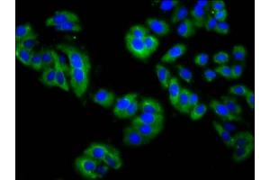 Immunofluorescence staining of HepG2 cells with ABIN7158901 at 1:200, counter-stained with DAPI. (MPP3 Antikörper  (AA 301-432))