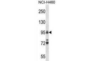 Western Blotting (WB) image for anti-Topoisomerase (DNA) I (TOP1) antibody (ABIN2997609) (Topoisomerase I Antikörper)