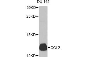Western blot analysis of extracts of DU 145 cells, using CCL2 Antibody (ABIN5974379) at 1/1000 dilution.