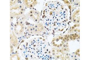 Immunohistochemistry (Paraffin-embedded Sections) (IHC (p)) image for anti-Polynucleotide Kinase 3'-Phosphatase (PNKP) antibody (ABIN7262583)