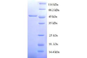 SDS-PAGE (SDS) image for Matrix Metallopeptidase 12 (Macrophage Elastase) (MMP12) (AA 109-470), (partial) protein (His tag) (ABIN5709939) (MMP12 Protein (AA 109-470, partial) (His tag))