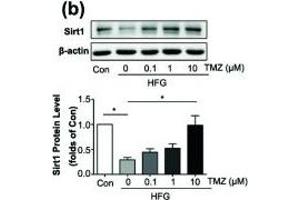 Trimetazidine (TMZ) reduced HFG-induced ROS generation and EMT depending on upregulation of Sirt1. (SIRT1 Antikörper  (AA 448-747))