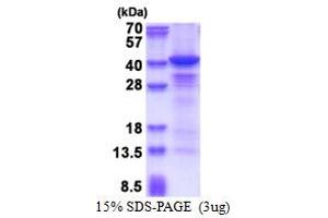 SDS-PAGE (SDS) image for Casein Kinase 1, alpha 1 (CSNK1A1) (AA 1-337) protein (His tag) (ABIN5853612)